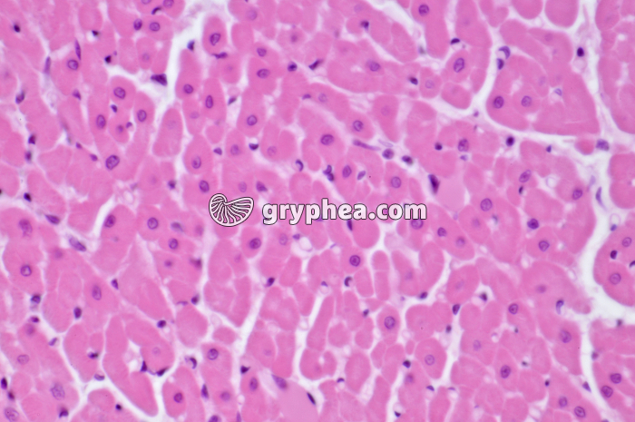 Mucle cardiaque CT x160 - gryphea.com